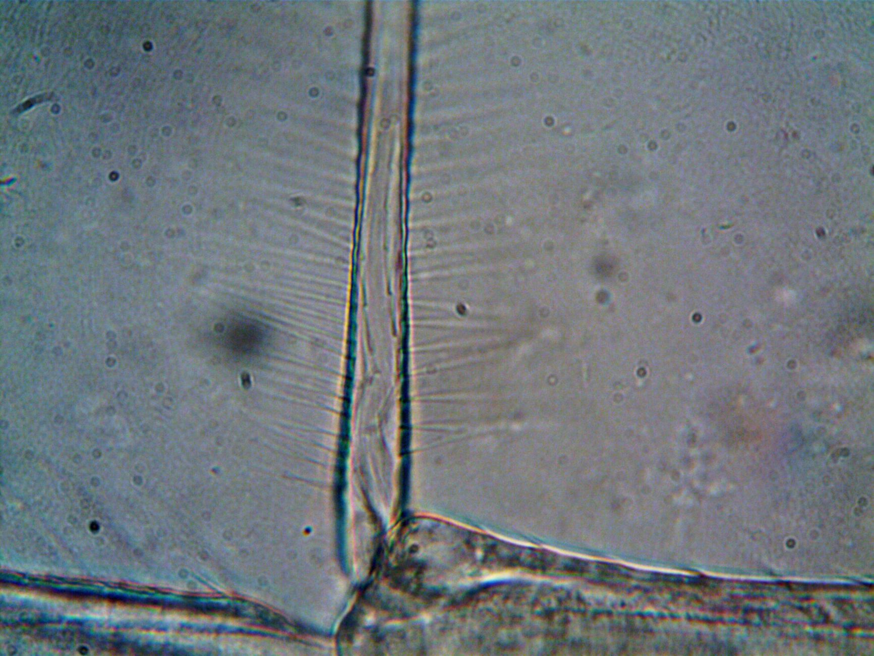 Trichophyton species analysis: Is It the Best Method?